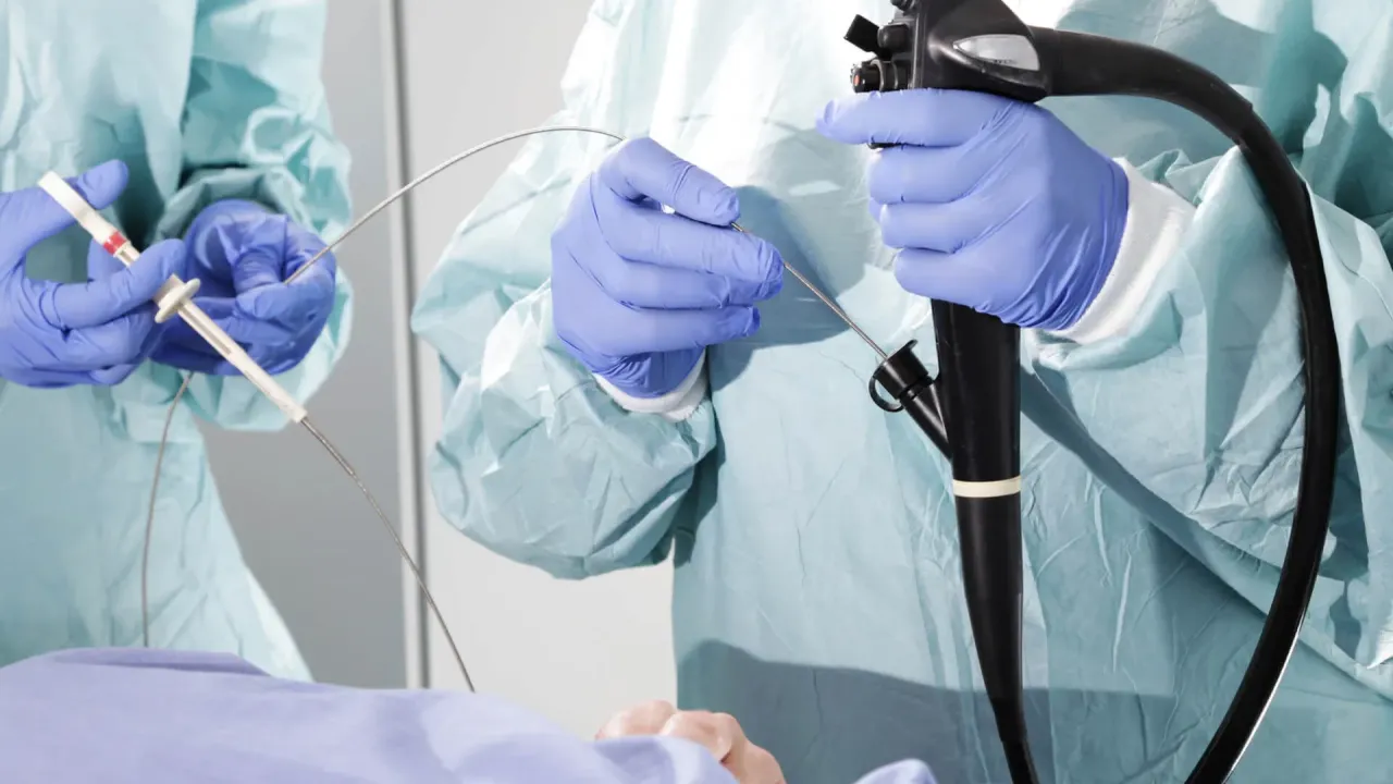 Endoskopide yeni yöntem: “Kapsül Endoskopi”