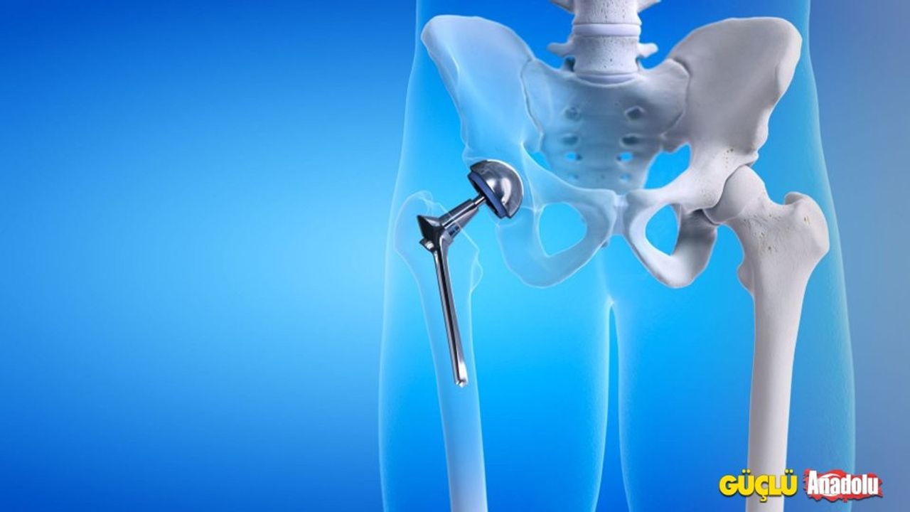 Kalça protezi ameliyat nasıl yapılıyor?