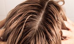 Saç yağlanmasına karşı çözümler! Saç yağlanmasına ne iyi gelir?