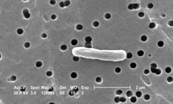 E. Coli bakterisi nedir? Nasıl bulaşır?