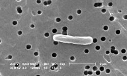 E.Coli bakterisi nedir, hangi hastalıklara sebep olur?