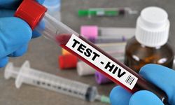 HIV/AIDS nedir? Belirtileri nelerdir?