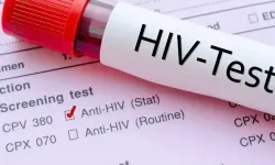 Erken teşhis HIV'i kontrol altında tutuyor