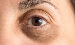 Retina ve vitreus hastalıklarına dikkat