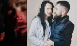 Ankara’da işkence iddiası: Burnu ve kulağı koptu