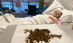 Safra kesesinden 20 bin taş çıktı