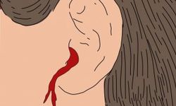 Rüyada kulak kanaması görmek ne anlama gelir?