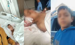 Ankara'da köpeklerin saldırısına uğrayan çocuğun tedavisi sürüyor