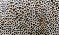 Tripofobi nedir? Neden Olur?