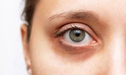 Baş ağrısı ve bulanık görme göz hastalığı belirtisi olabilir