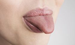Dildeki belirtiler hangi hastalıkların işareti?