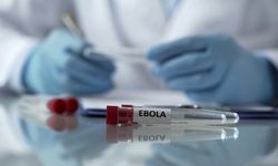 Ebola virüsü nedir, belirtileri nelerdir? Hastalıktan nasıl korunulur?