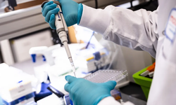 Melanomda mRNA tedavisi Faz 3’te başarılı oldu