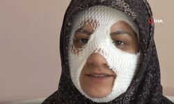 Bomba Gibi Patlayan Düdüklü Tencere Genç Kadına Dehşeti Yaşattı