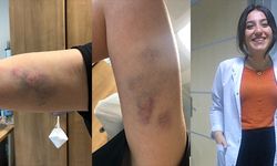 COVİD-19 hastası 'Bana bakmak zorundasın' diyerek hekime saldırdı