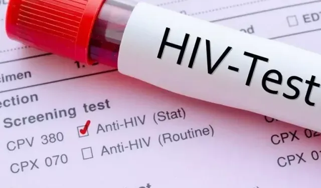 Türkiye’de HIV vakaları genç yaş gruplarında artıyor