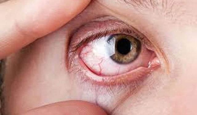 Dr. Ayşe Kaplan: Göz tansiyonu sinsi ilerliyor