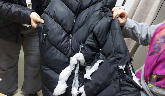 Ankara Elmadağ'da bir kadına köpek saldırdı