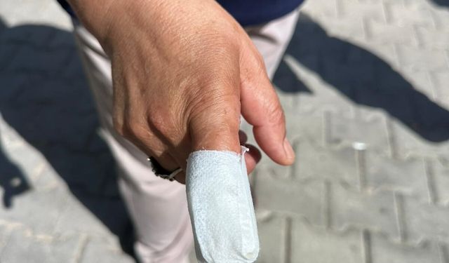 İzmir'de pitbull saldırısında 5 çocuk annesinin parmağı koptu