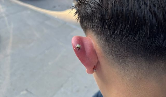 Bursa'da piercing yaptıran 17 yaşındaki genç hastanelik oldu