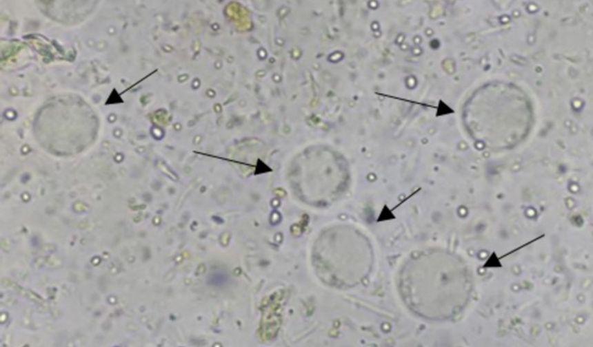 Hayvan türlerinde ‘Blastocystis’in Varlığı’ araştırılacak