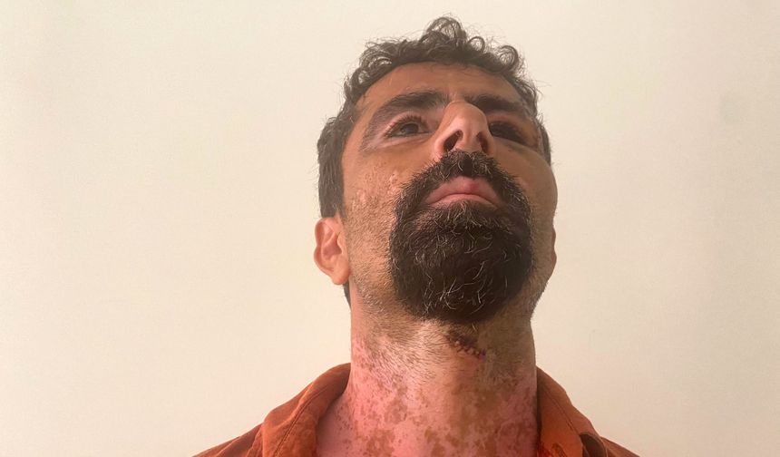 Antalya’da damat saldırısı! Kayınpederinin başına 13 dikiş atıldı