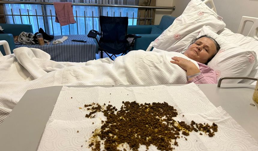 Safra kesesinden 20 bin taş çıktı