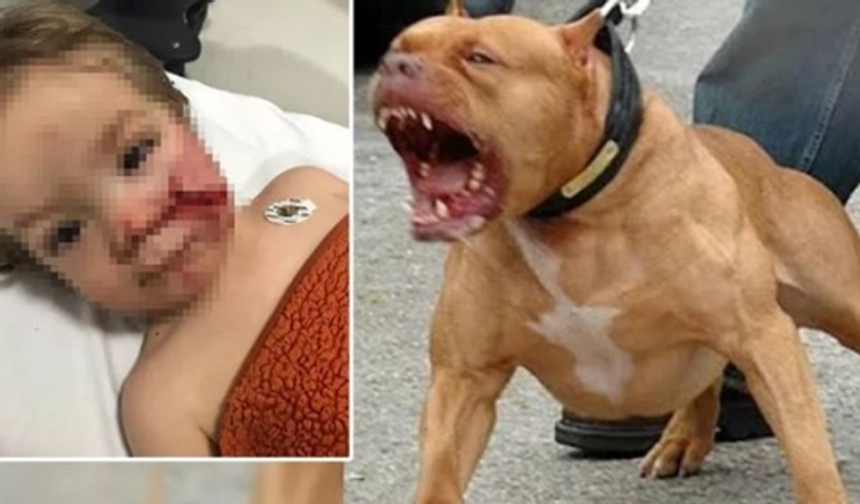Etimesgut’taki pitbull saldırısında köpek sahibi tutuklandı