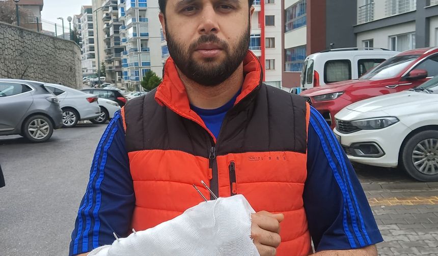 Ankara’da sahipsiz köpeklerden kaçarken düştü