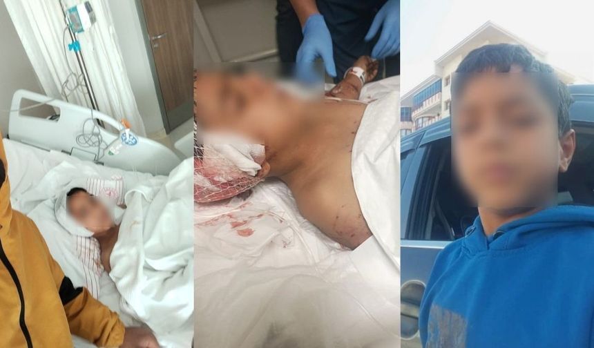 Ankara'da köpeklerin saldırısına uğrayan çocuğun tedavisi sürüyor