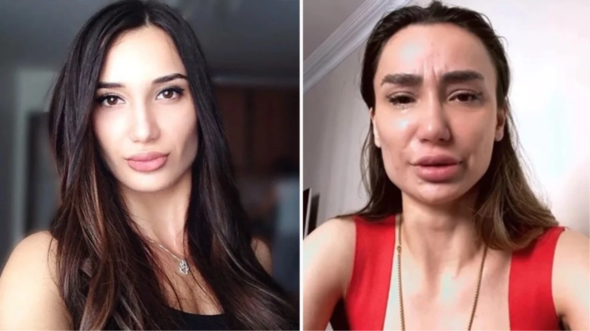 Emre Asik In Eski Esi Yagmur Sarnic Intihara 17229789 1758 Amp