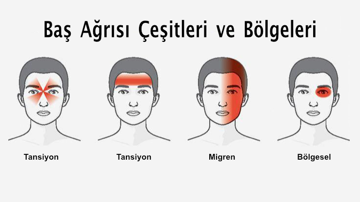 Bas Agrisi Cesitleri Ve Bolgeleri