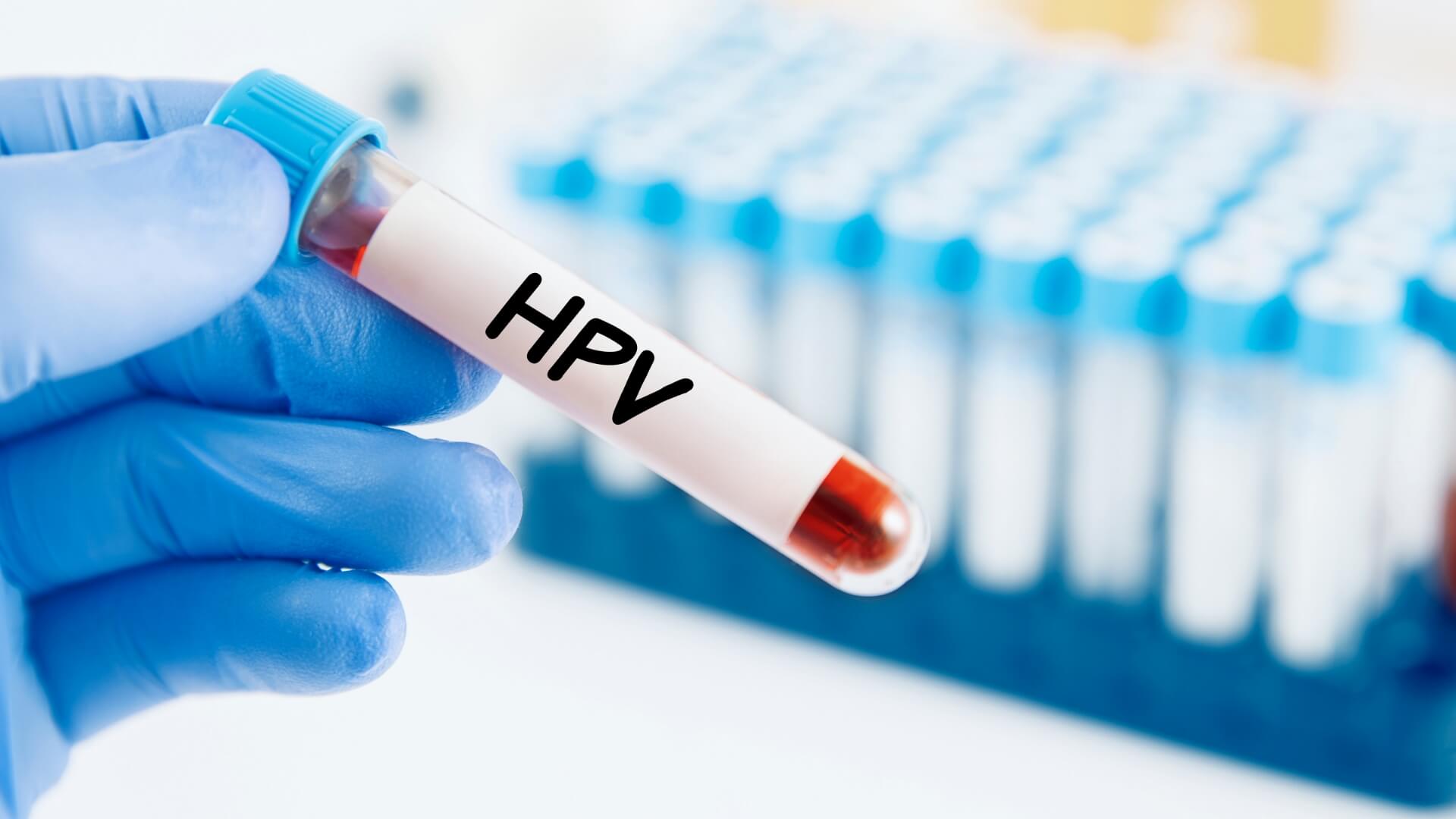 Hpv-1