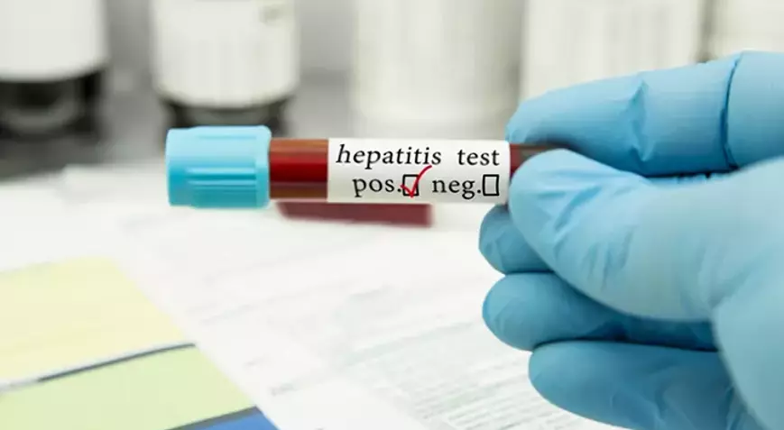 Hepatit2