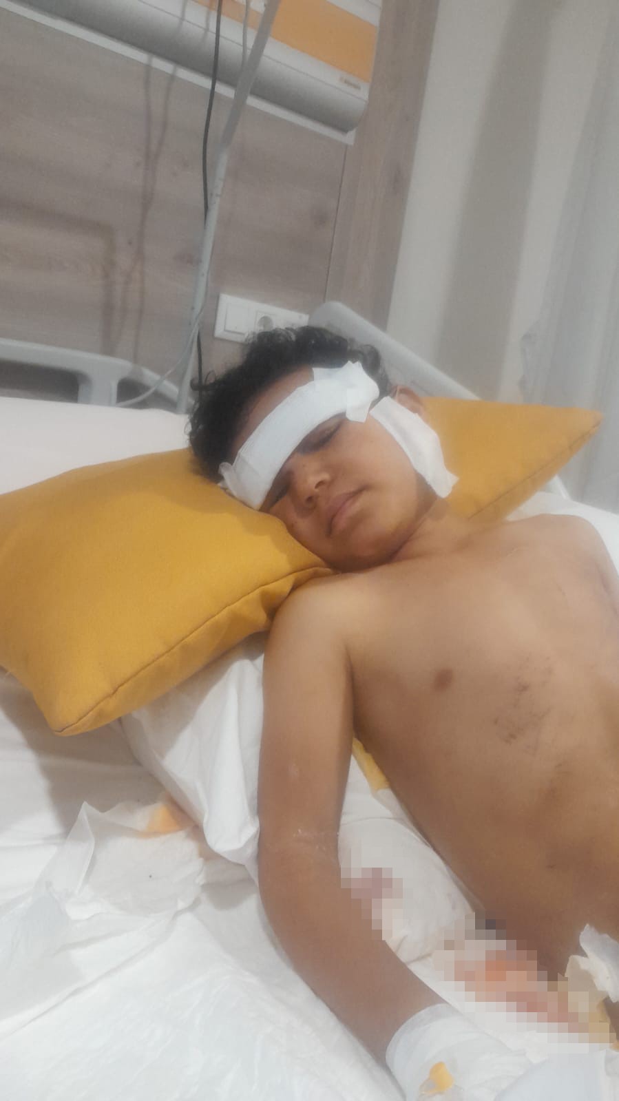 Çocuk Köpek Saldırısı (3)