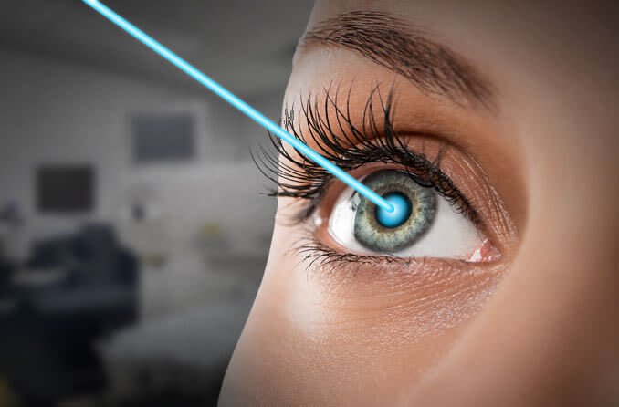 Lasik Goz Ameliyati3