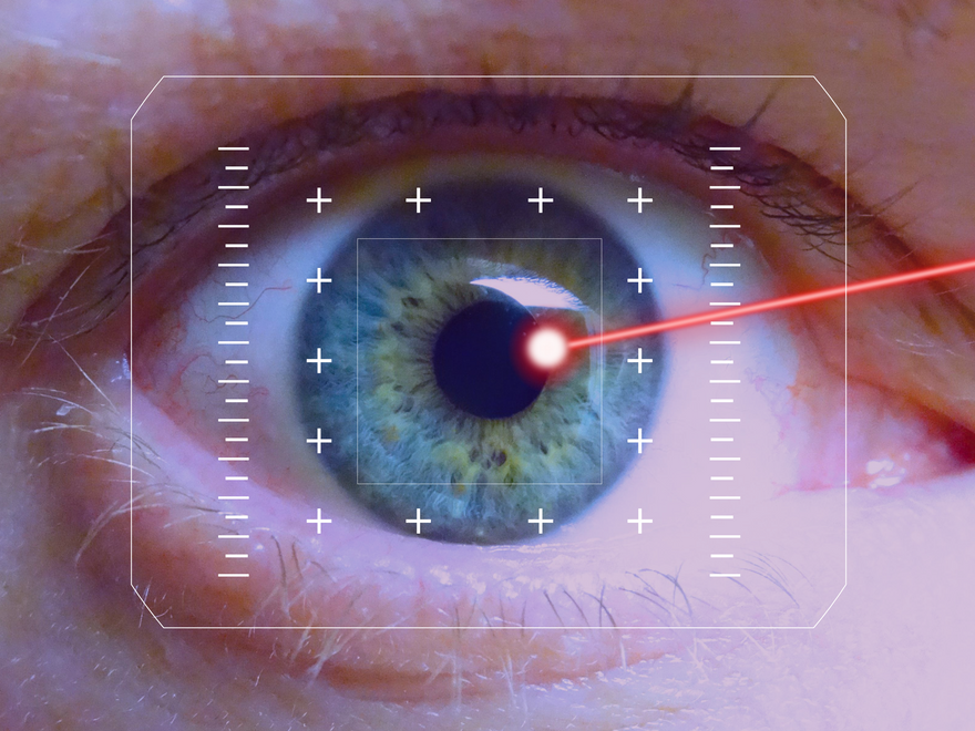 Lasik Goz Ameliyati4