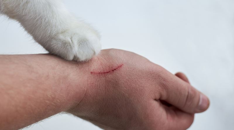 Kedi Tırmalaması1