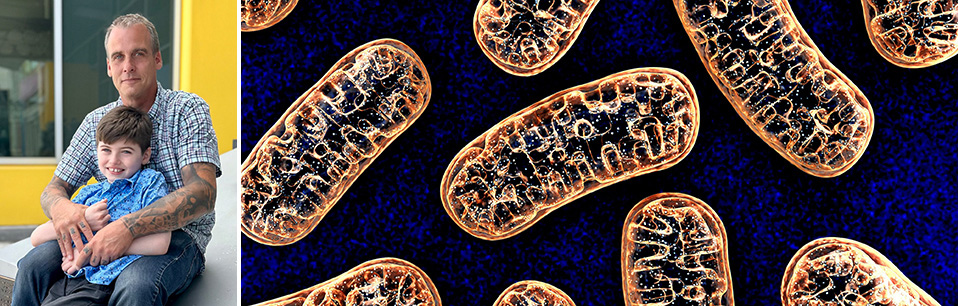 Polg Disease (4)