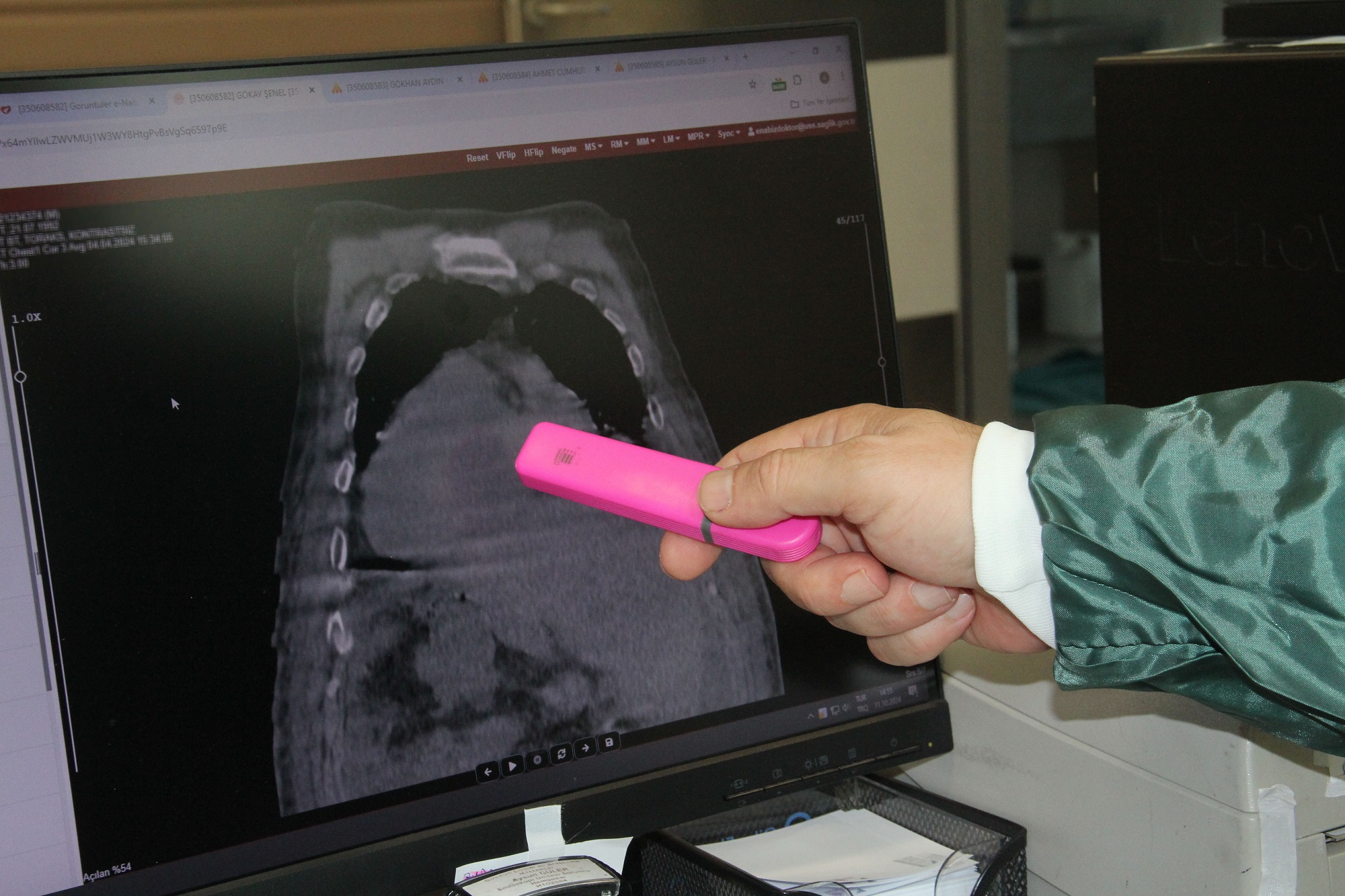 Karadeniz Sendromu (2)