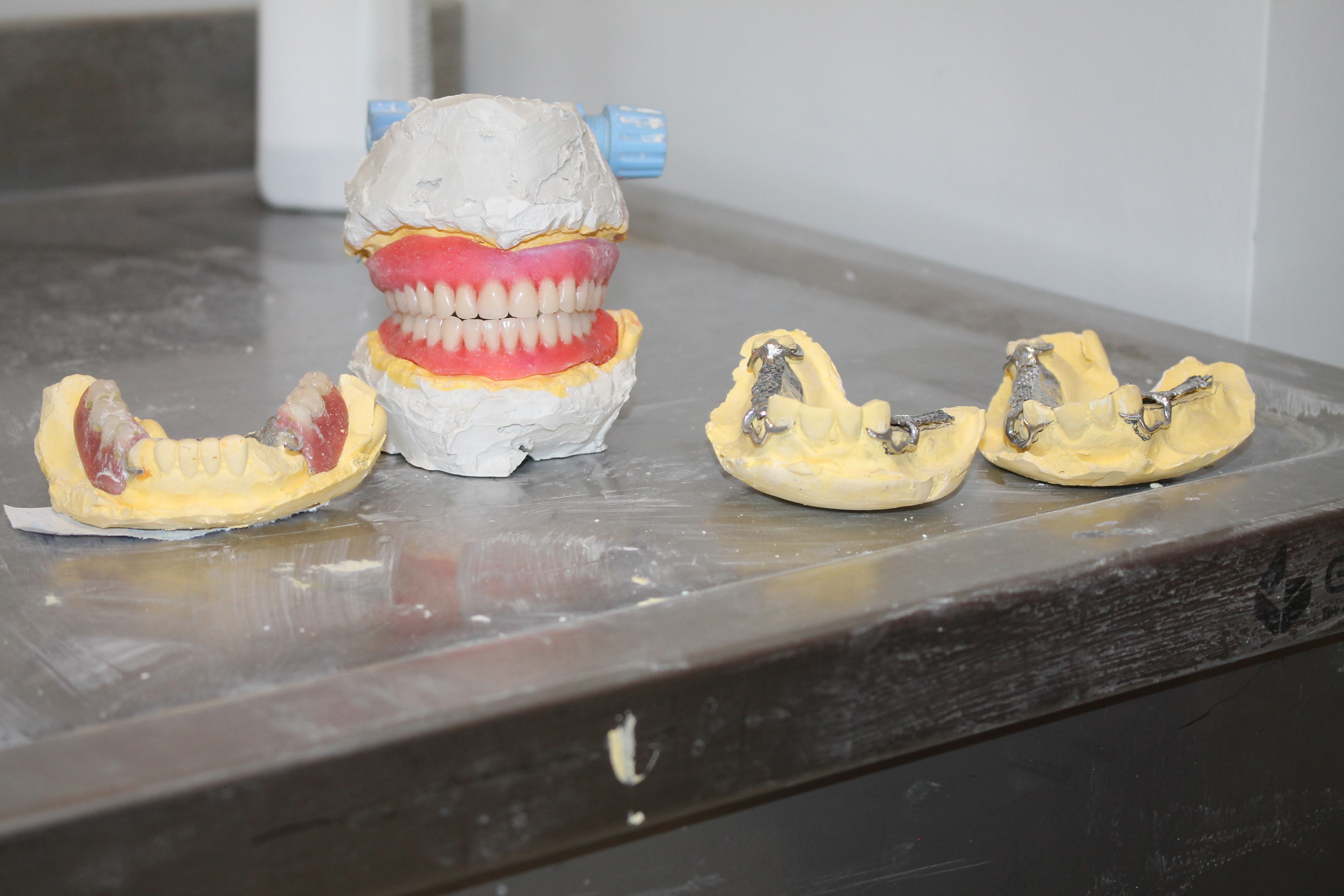 Midyat'ta Modern Protez Uygulamaları (1)