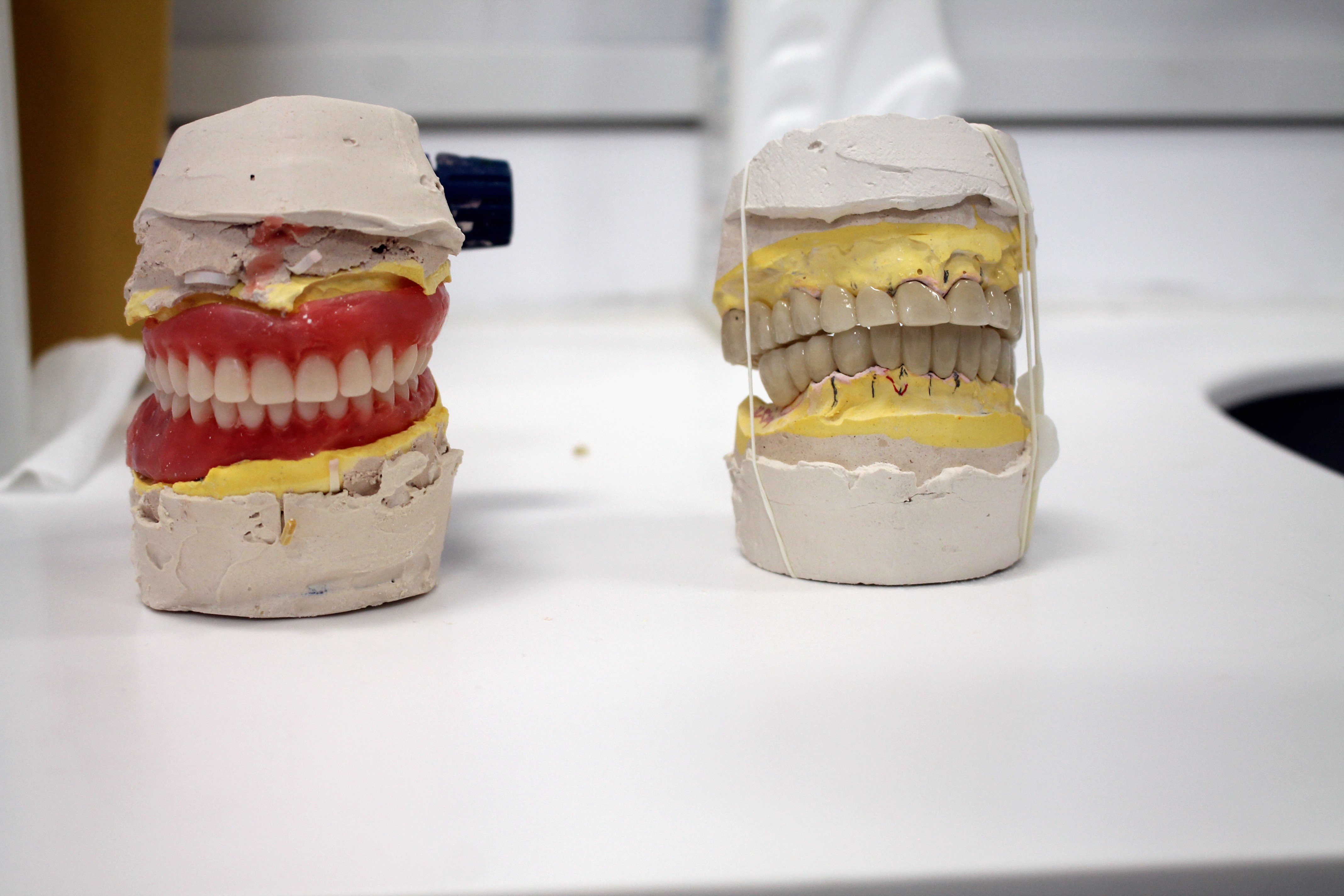 Midyat'ta Modern Protez Uygulamaları (2)