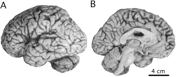 Deli Dana Hastaligi.jpg2