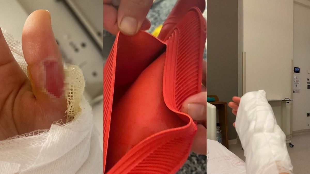 Sıcak Su Torbası Kabusa Döndü