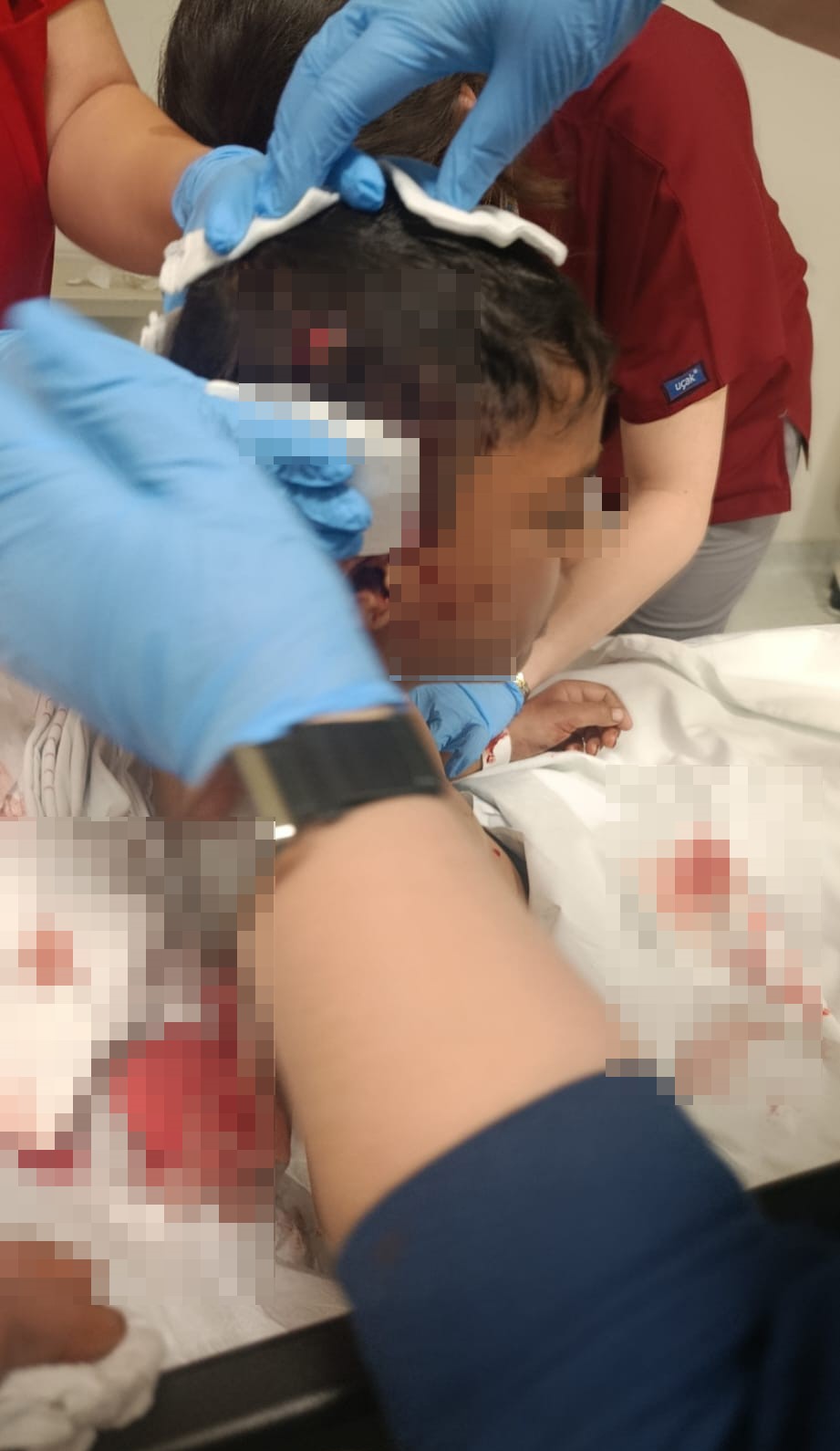 Altındağ’da başıboş köpek dehşeti - 2