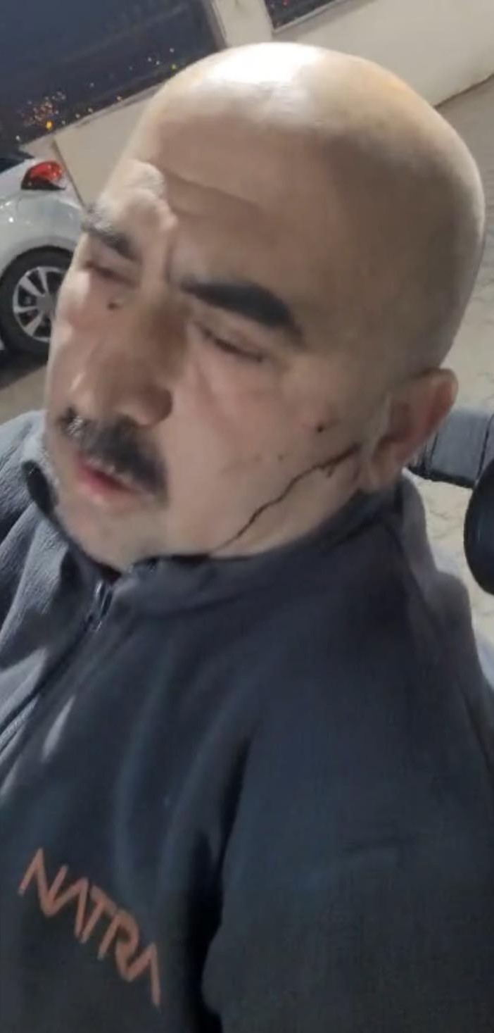 Elmadağ’da mobilya fabrikasında darp iddiası - 2