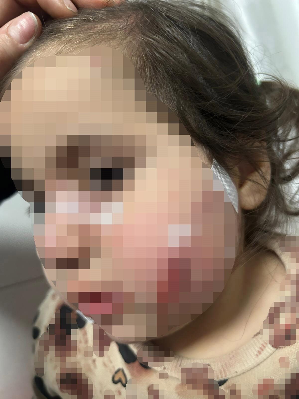 İzmir’de 3 yaşındaki çocuğa köpek saldırısı - 4