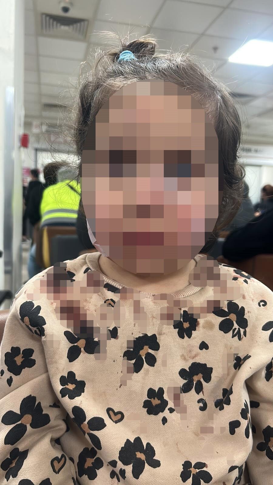 İzmir’de 3 yaşındaki çocuğa köpek saldırısı - 3