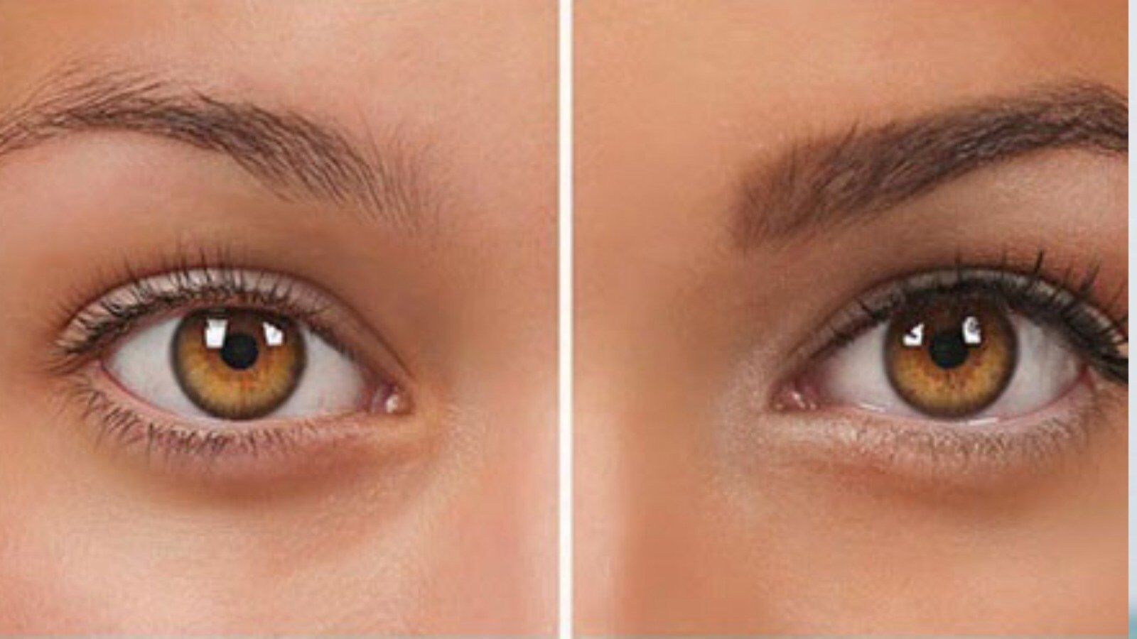 Seyrek Kaşları Güçlendirme.jpg1