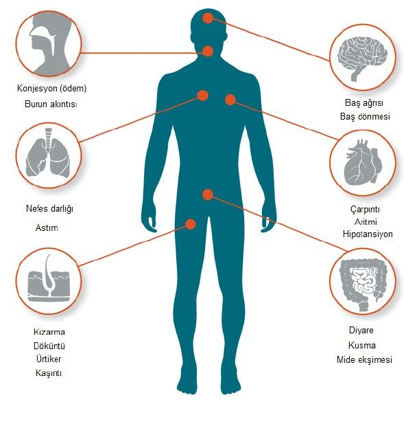 Histamin
